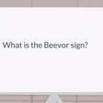 Beevor's sign